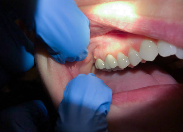 Best Cracked Tooth Emergency Dentist  in Woodcliff Lake, NJ